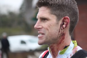 Scott Ear injury